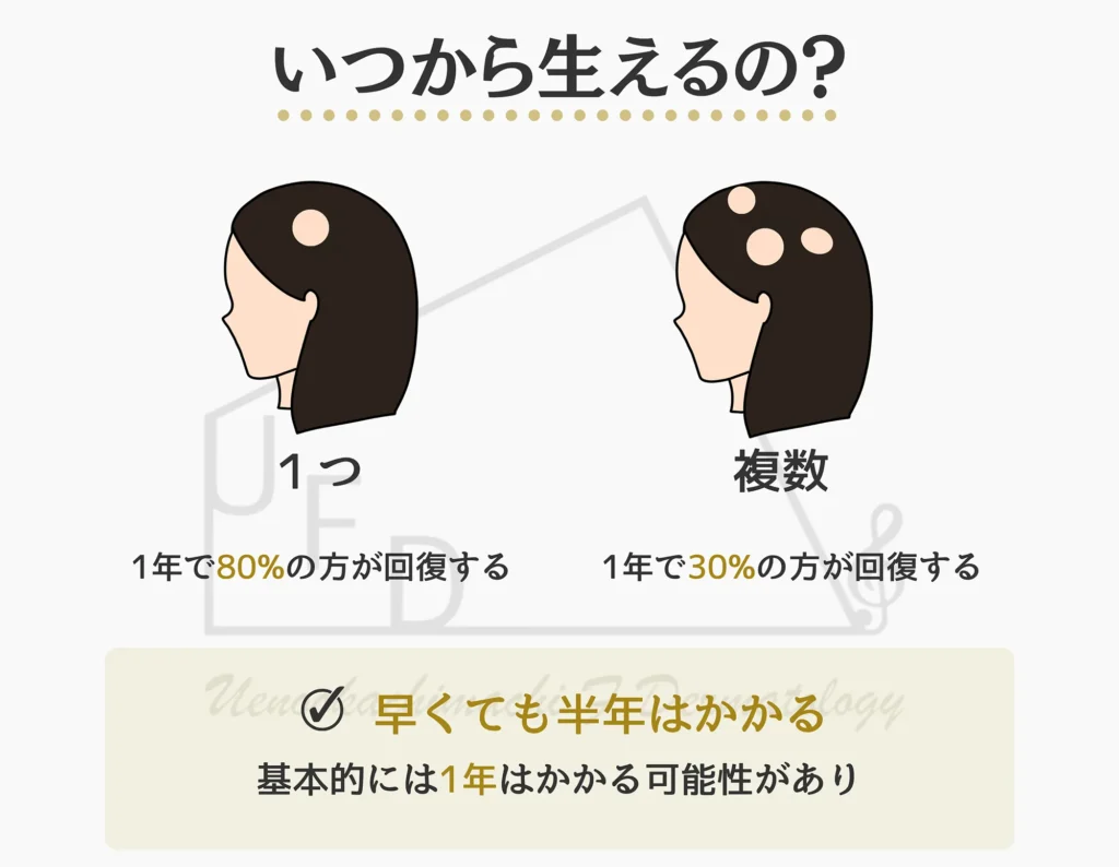 円形脱毛症が改善した場合、髪が再び生える時期について画像付きで解説