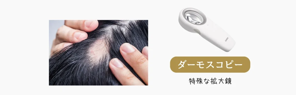 診断方法１ ダーモスコピーを使用した方法