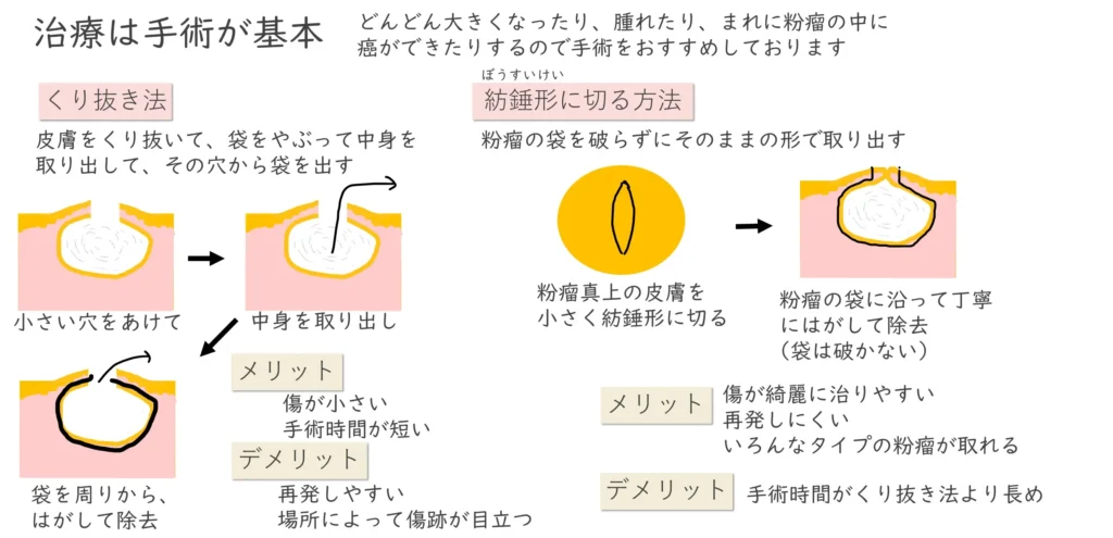 治療は手術が基本
