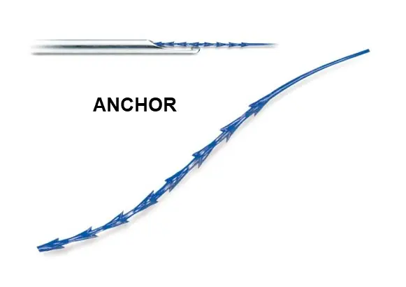 アンカースレッド