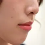 顔のほくろ画像