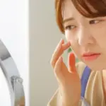 これってニキビ？いぼ？もしかしたら脂腺増殖症の可能性も