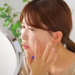 汗管腫とは？原因から治療法・保険適用の有無まで徹底解説