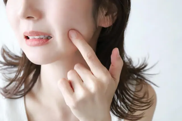 【クレーター状のニキビ跡に効果あり】サブシジョンについて解説