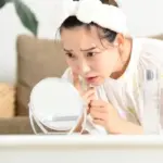 イソトレチノインでニキビ改善！治療効果と副作用、注意点を徹底解説