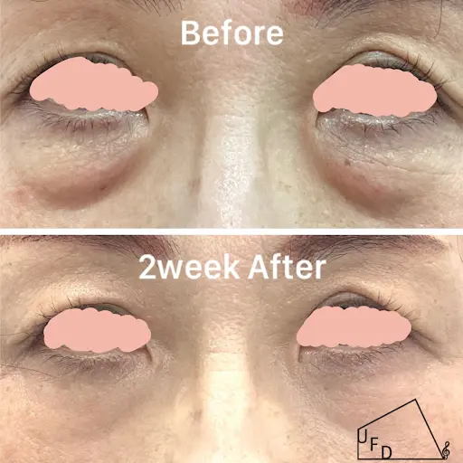 症例1 【60歳代女性】