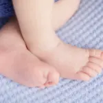 扁平母斑（へんぺいぼはん）とは？原因から治療・保険適用まで徹底解説