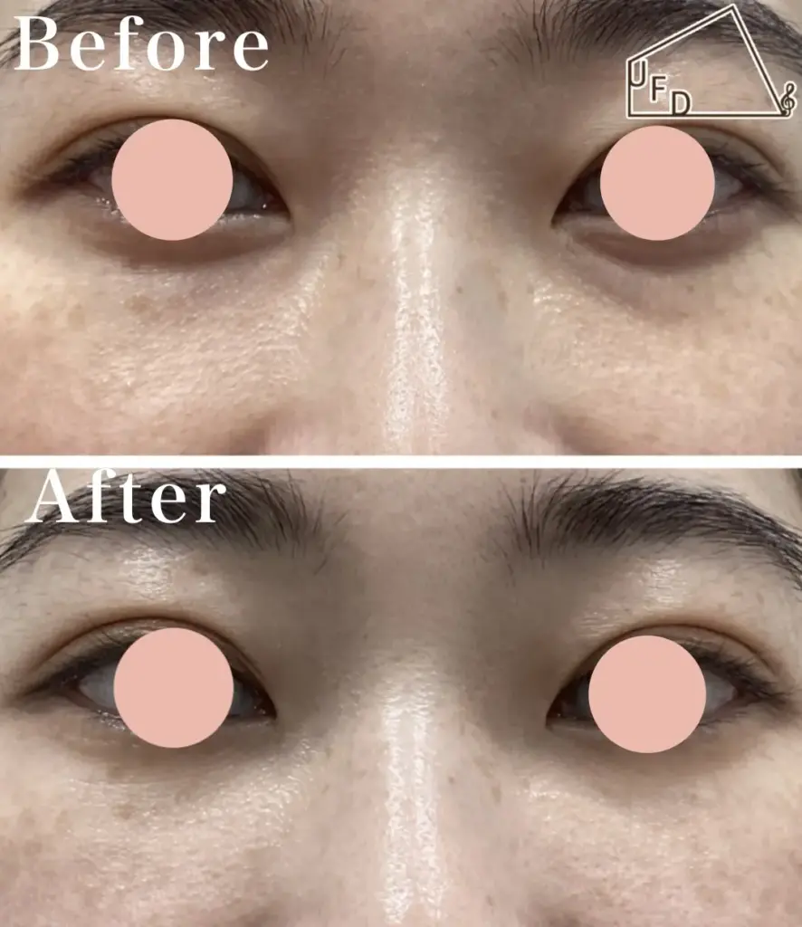 症例3 【20歳代女性】