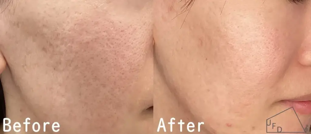 ジュベルックの症例1