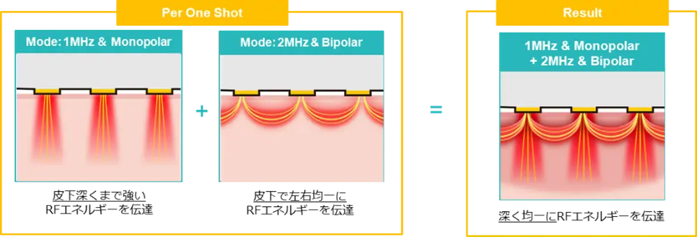 ポテンツァダイヤモンドチップの説明