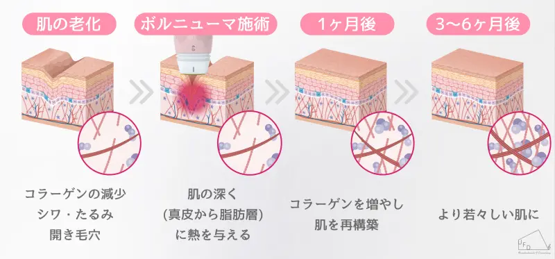 ボルニューマの効果