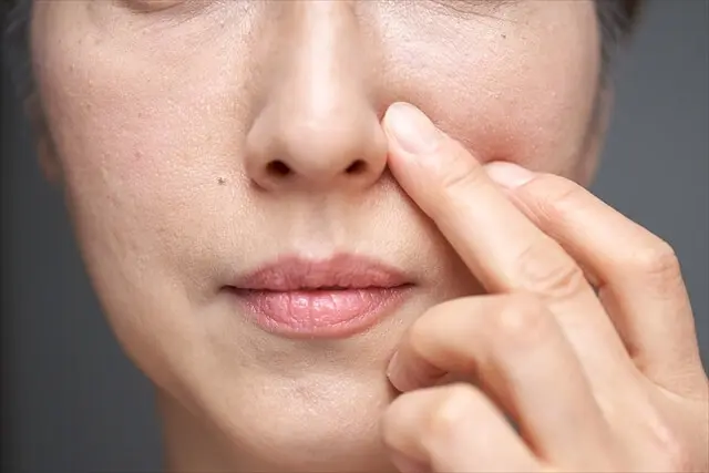 糸リフトってどんな治療?|施術内容や治療後に気を付けるべきこともご紹介