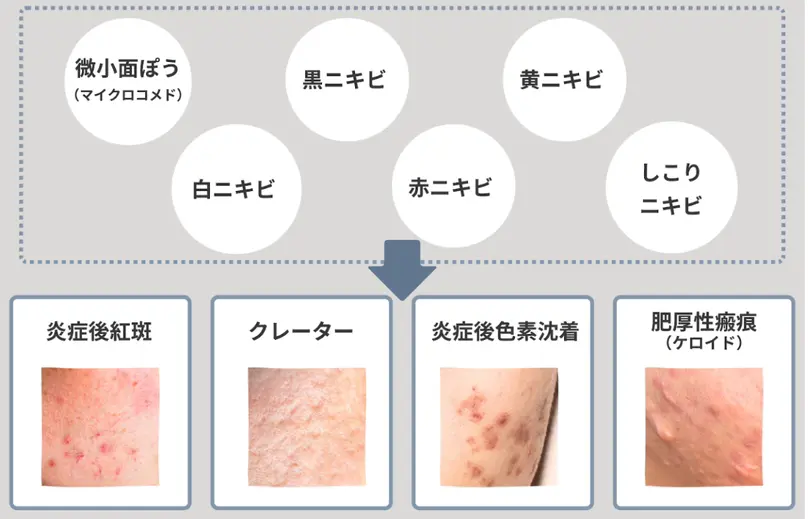 皮膚科診療プラクティス 11 （名前消し跡 難） 皮膚科学（第11版） - 株式会社 金芳堂