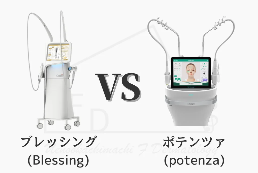 最新の美容機器ブレッシングと定番のポテンツァの違いについて徹底解説します