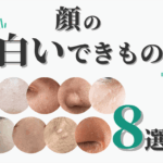 顔の白いイボの正体は？原因・種類・見分け方と治療法を皮膚科専門医が徹底解説【脂漏性角化症・稗粒腫・汗管腫など】