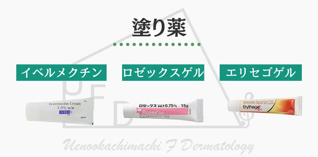 塗り薬による治療法　イベルメクチン　ロゼックスゲル　エリセゴゲルについて解説