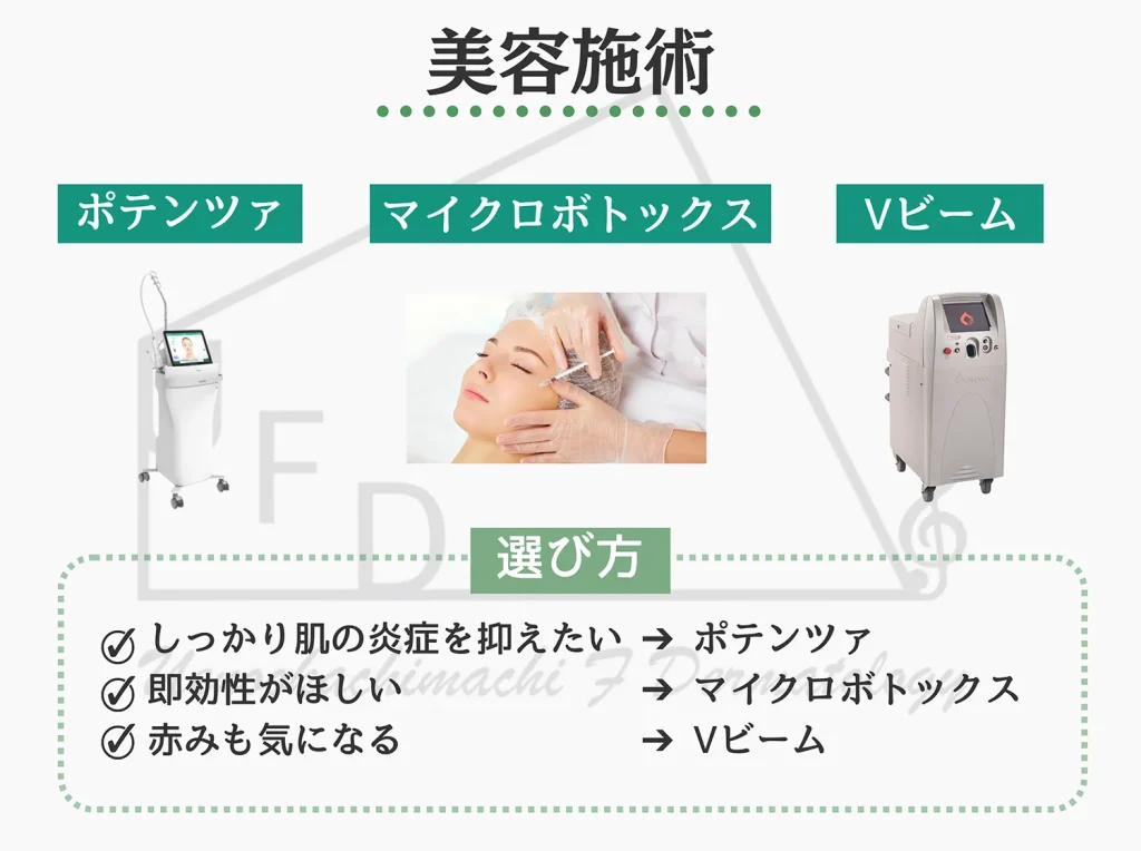 しっかり治したい方には美容施術　ポテンツァ　マイクロボトックス　Vビームについて解説