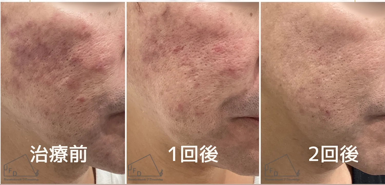 当院の治療症例についてご紹介　症例1