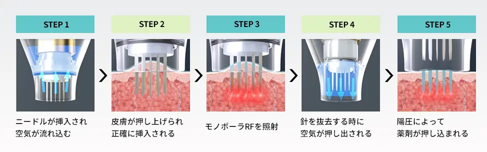 ポテンツァの仕組み