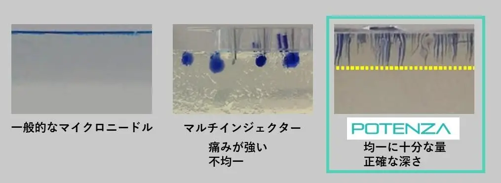 ドラッグデリバリーシステムの説明