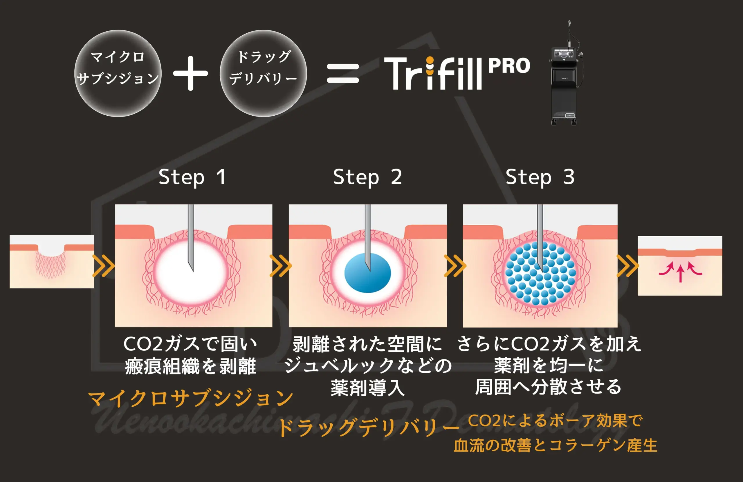 トライフィルプロの特徴