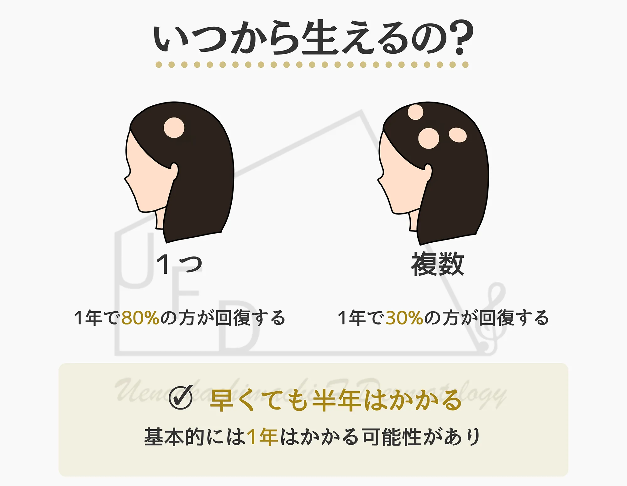円形脱毛症が改善した場合、髪が再び生える時期について画像付きで解説