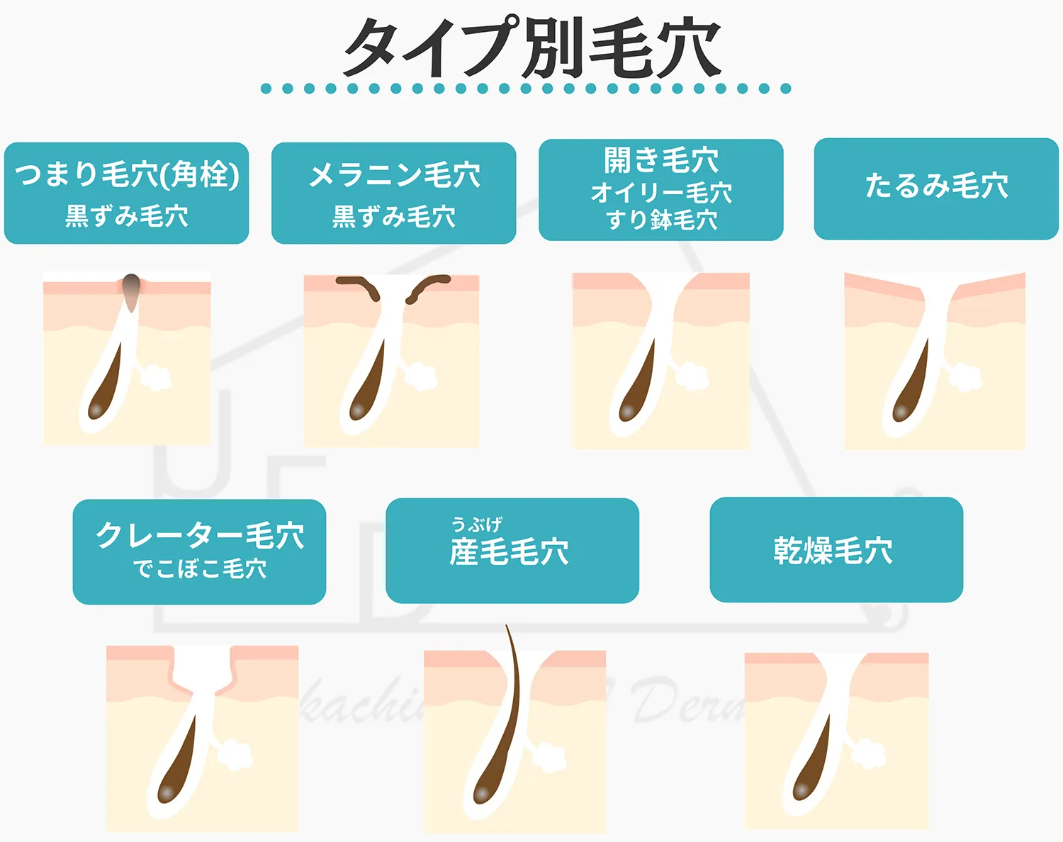毛穴タイプは全部で5種類あります 画像付きでそれぞれを詳しく解説します