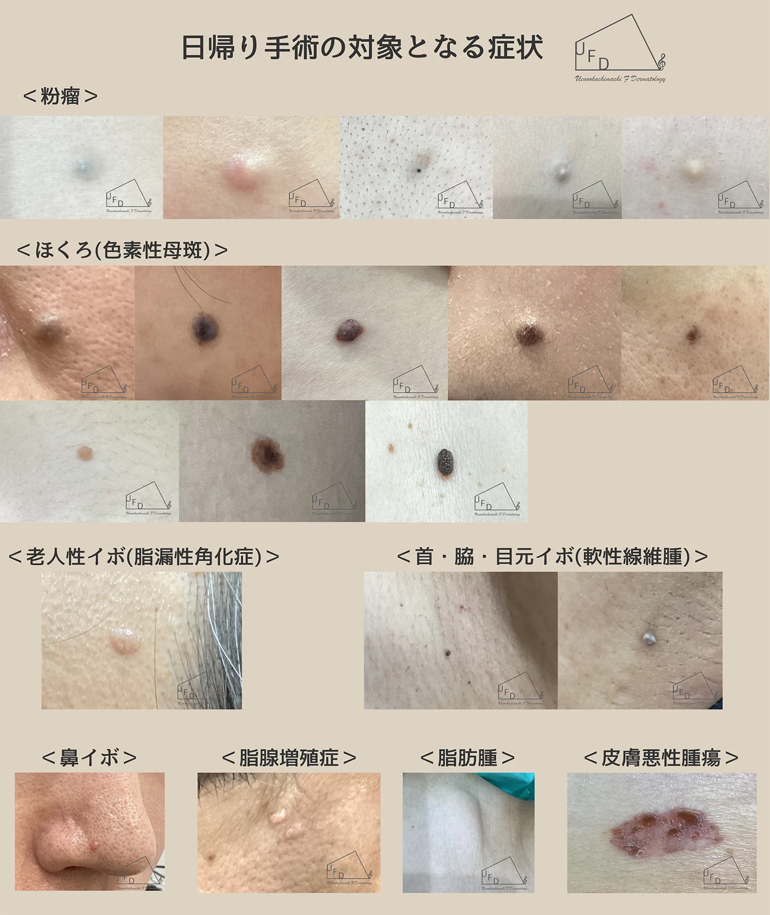 日帰り手術ができる症状一覧