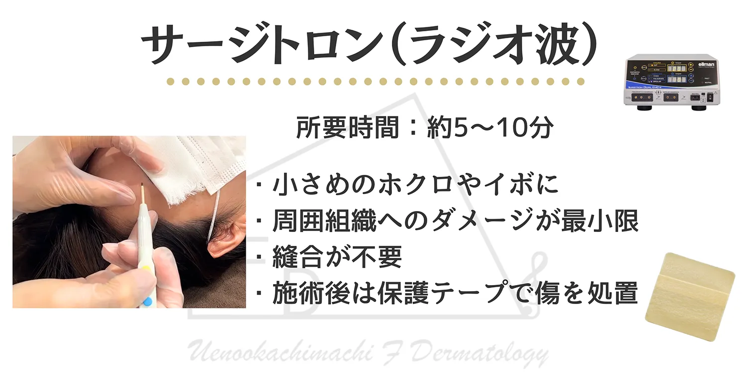 サージトロン(ラジオ波)を用いた機器による治療