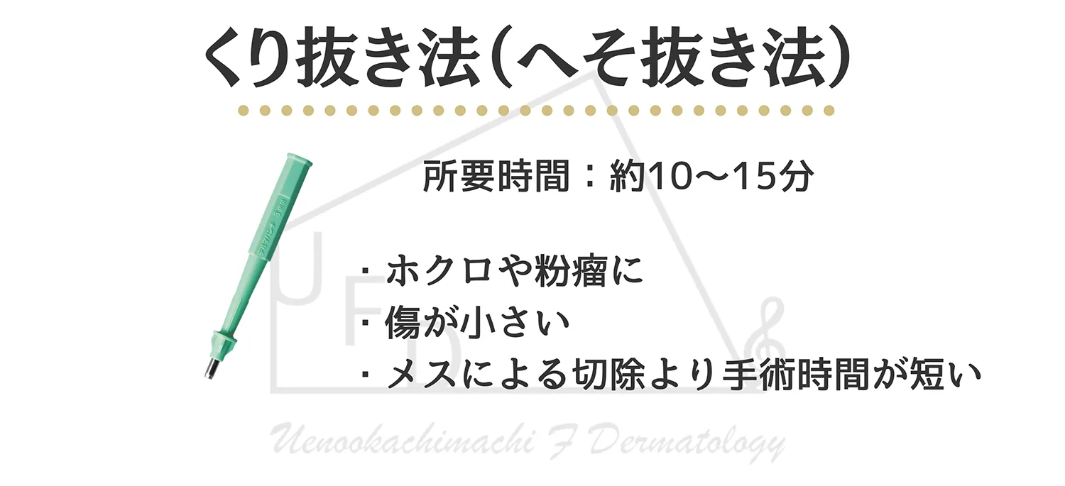 くり抜き法(パンチ法・へそ抜き法)による治療
