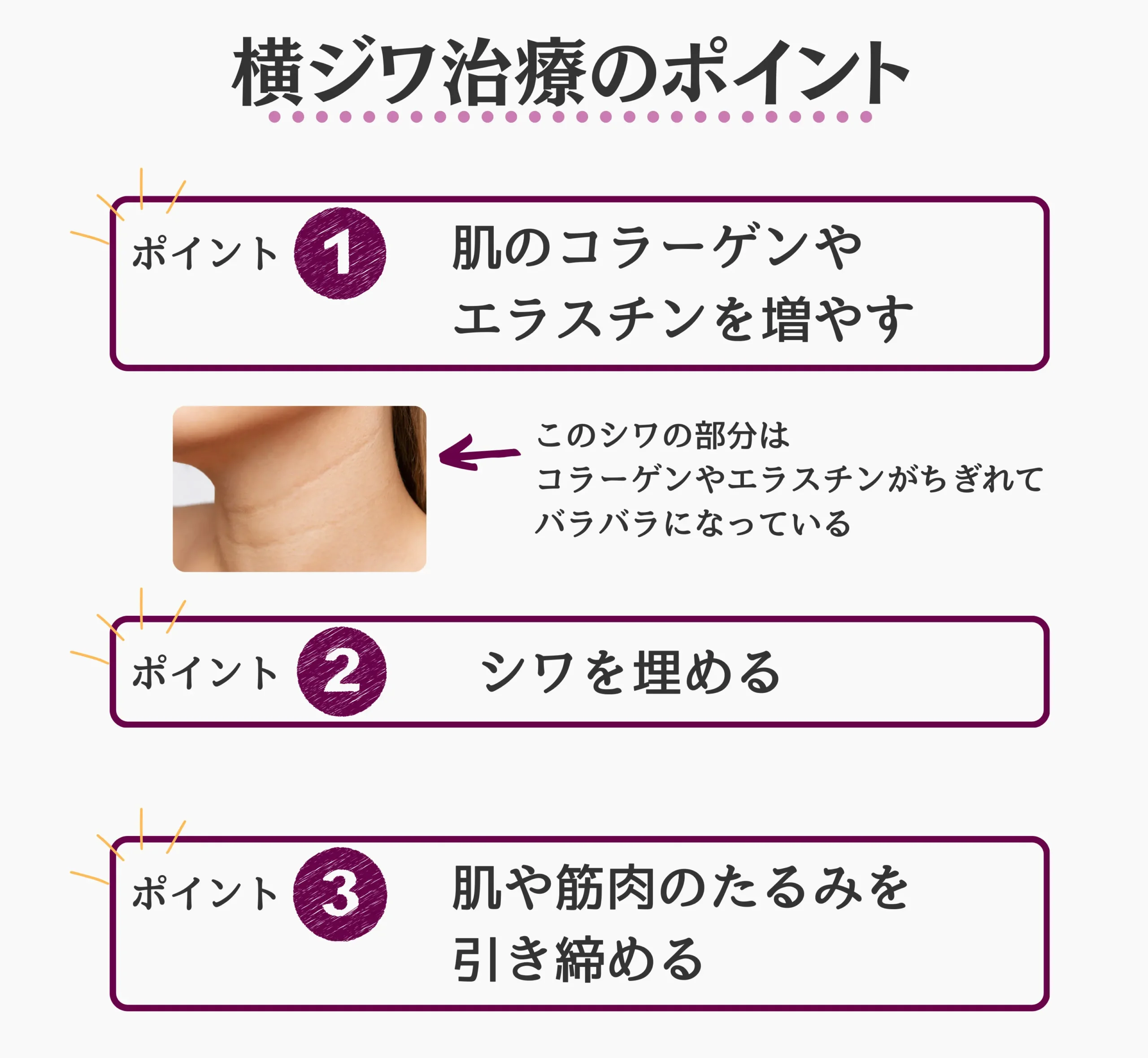 首の横ジワ治療のポイントをまとめた画像