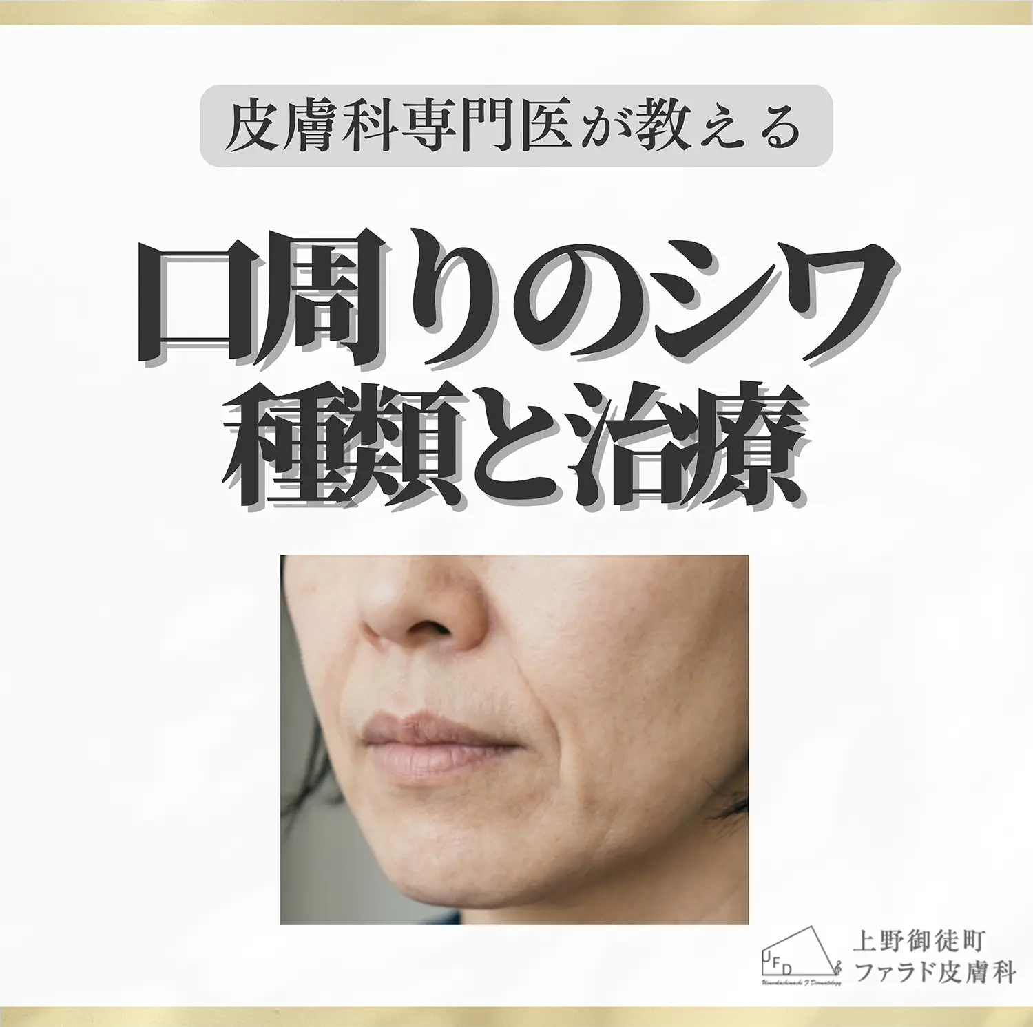 口周りのシワの種類と治療 コラムのサムネイル