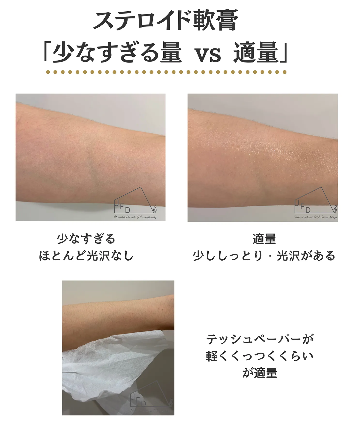 ステロイド軟膏の少なすぎる量と適量を比べた写真。適量は少ししっとりして光沢が出る程度、ティッシュペーパーが軽く付く程度