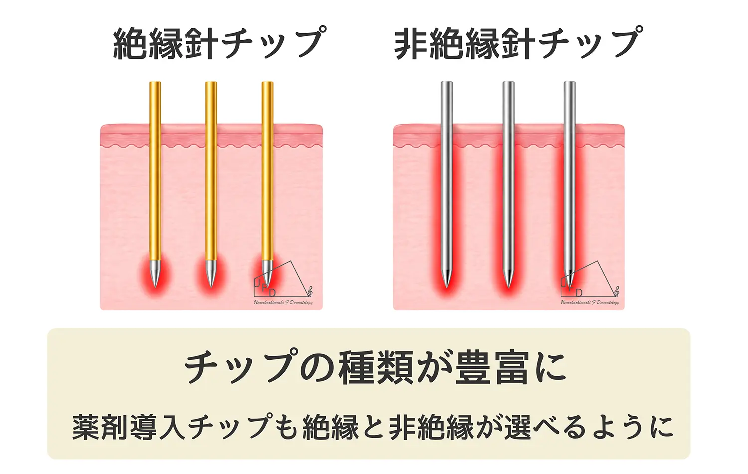 ポテンツァとポテンツァプライムの違い チップについて
