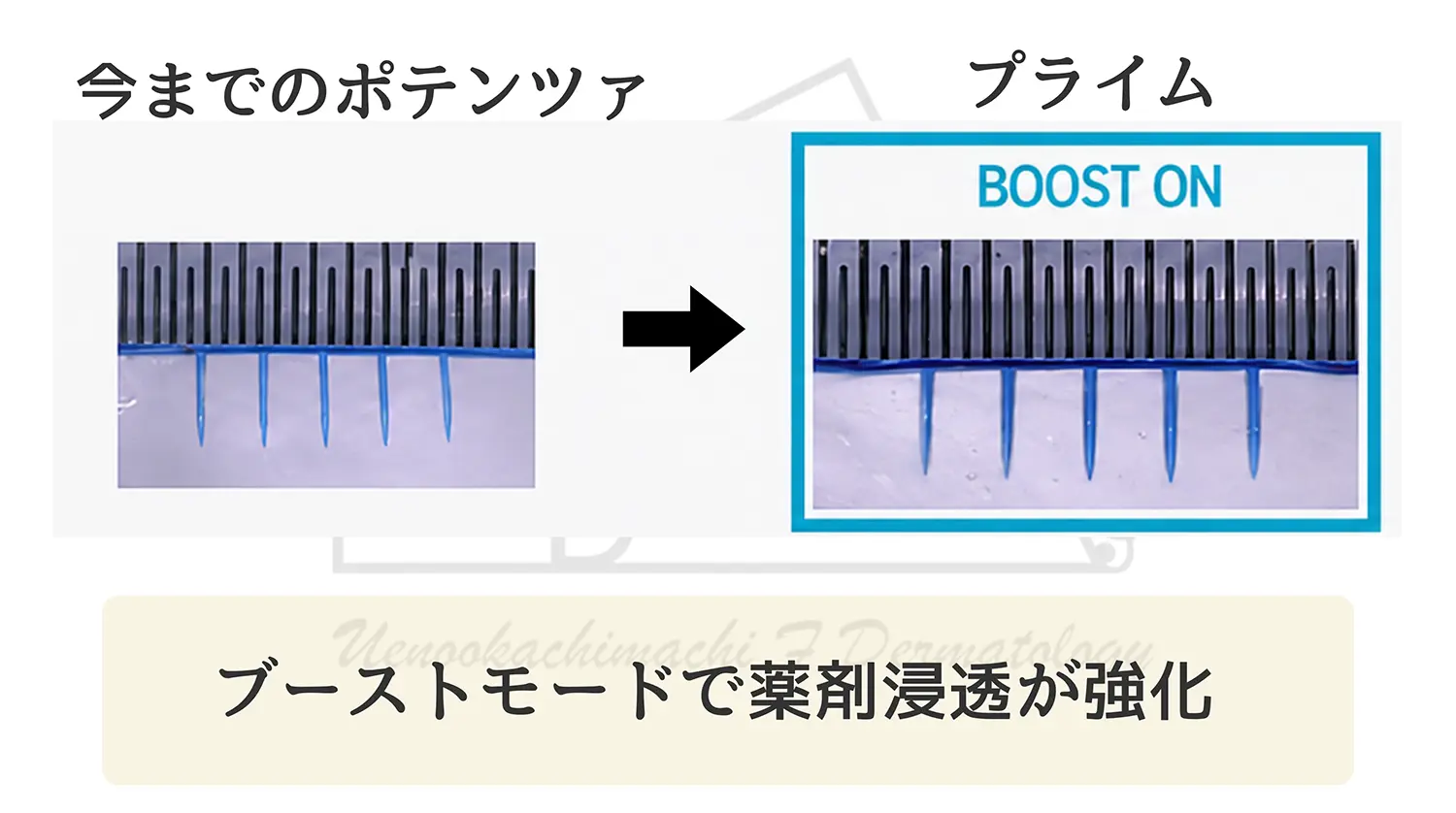 ポテンツァとポテンツァプライムの違い ドラッグデリバリー