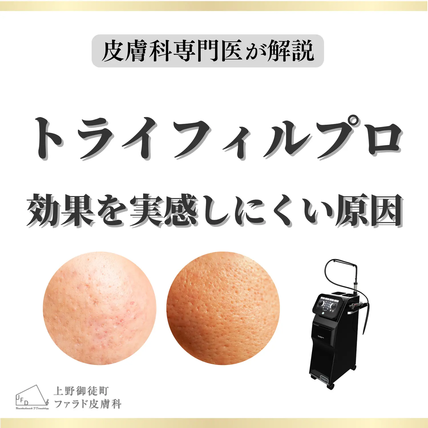 トライフィルプロの効果を実感しにくい原因を皮膚科専門医が解説するタイトル画像