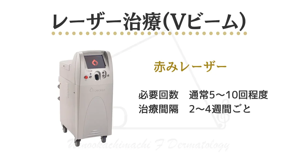 小鼻の赤みの治療に使うレーザー機器Vビームと説明の画像