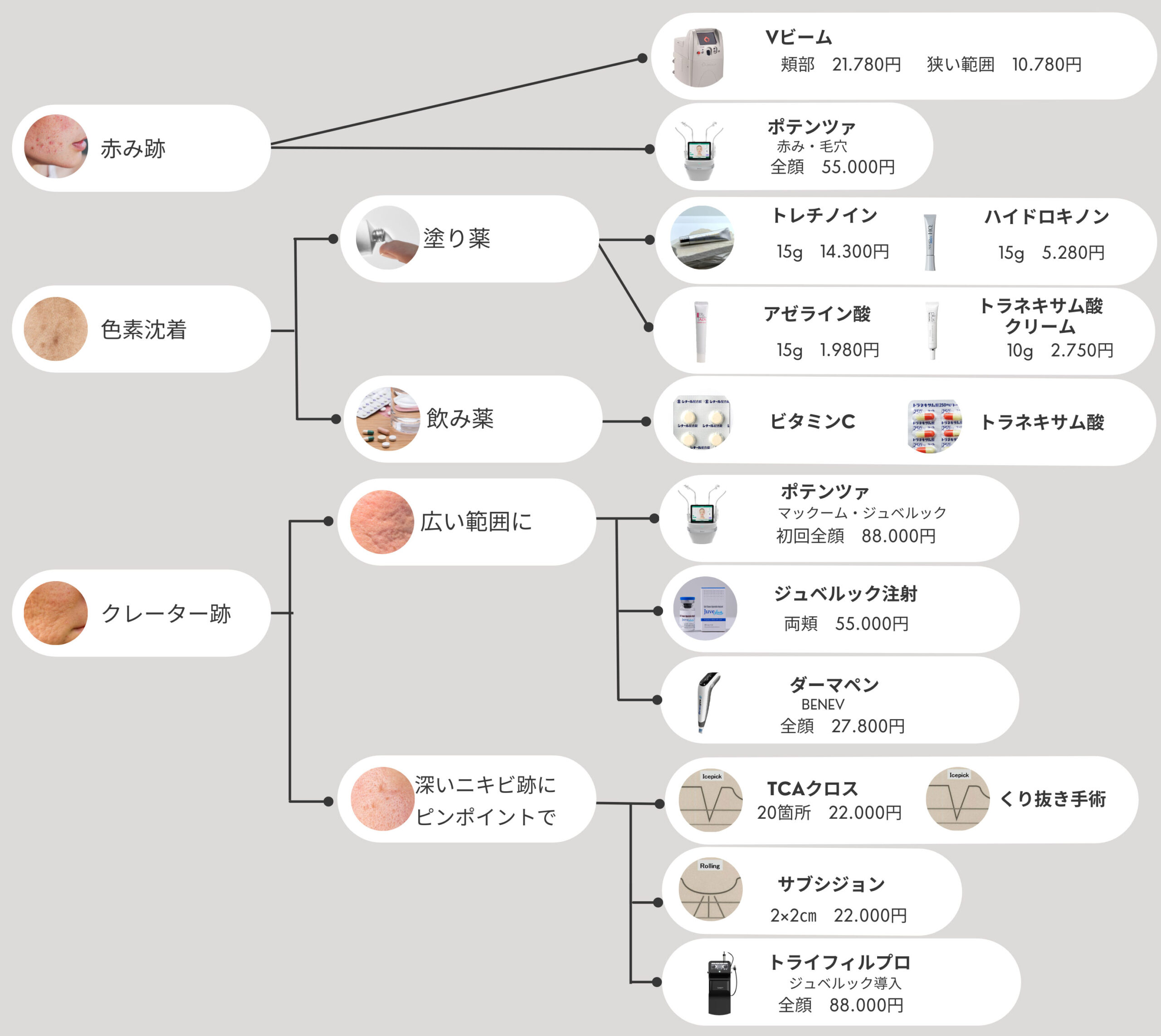 ニキビ治療一覧図