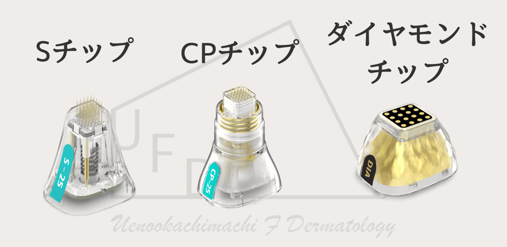 ポテンツァで使用するチップについて画像付きで徹底解説します　使用するチップはSチップ CPチップ ダイヤモンドチップ それぞれ照射できる種類と得意な症状で使い分けます